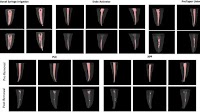 Efficacy of various techniques in calcium silicate-based intracanal medicament removal: a micro-CT analysis