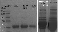 Figure 4: Gel electrophoresis of the purified polyclonal antibody...