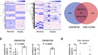 ER stress-induced LINC00173 promotes the apoptosis of ovarian granulosa cells by regulating the HRK/PI3K/AKT pathway in polycystic ovary syndrome