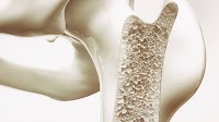 Mucus-based bioactive gel could replace the clinical gold standard of autografting