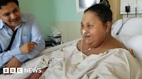 Egypt '500kg woman' loses half her weight after India surgery