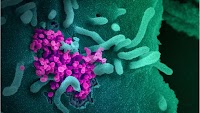 SARS-CoV-2 hijacks antiviral factors to promote infection in human lung cells