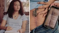 Her spine surgery was denied. Doctors say it's all too common.