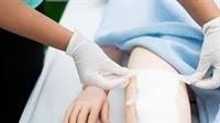 SolasCure announces final closing of GBP 10.9m (c. USD 13.3m) Series B fundraise to advance wound care innovation
