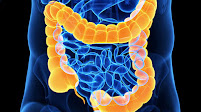 Panitumumab Combo Elicits Response in mCRC Subset