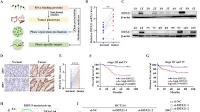 Phase separation of DDX21 promotes colorectal cancer metastasis via MCM5-dependent EMT pathway