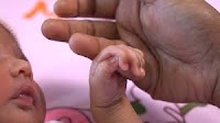 World Birth Defects Day