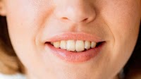 Cavities could be prevented by a gel that restores tooth enamel