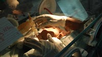 A Hormone Gel Helps Prevent Premature Births