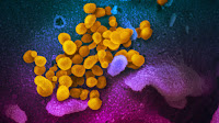 New coronavirus stable for hours on surfaces
