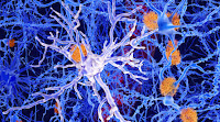 Eli Lilly's Alzheimer's candidate, Bob Langer's new startup, and other biotech news you need to know
