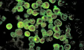 Teen's brain-eating amoeba infection likely linked to water feature