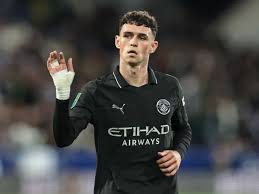 Preview: Manchester City vs Burnley - prediction, team news, lineups