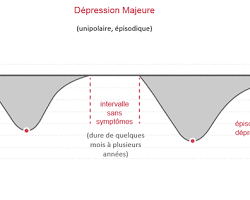 Symptômes de la dépression majeure