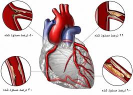 Image result for ‫آنژیوگرافی‬‎