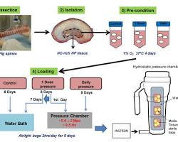 Image of Isolation process of human primary nucleus pulposus cells