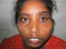 [Image: images?q=tbn:ANd9GcQ2Wlhtp0JCxCeEd1X4pGN...5DSa4L4YfE]