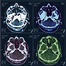 Image result for Medical Imaging