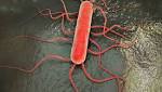 Cause listeriosis outbreak still unknown