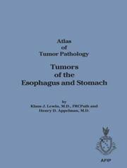Tumors of the Salivary Glands (Afip Atlas of Tumor Pathology) Ellis，Gary L.; Auclair，Paul L. 51QRc7ZgIuL._AC_SY200_QL15_.jpg