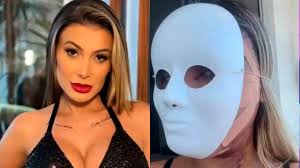 ‘Vou ter 23 anos novamente’: Andressa Urach mostra novo rosto após cirurgia radical
