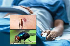 Por primera vez, Yucatán cae al tercer puesto en miasis humana por gusano barrenador del ganado