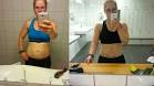 Bodylift - Privathospitalet, Fana Medisinske