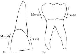 Resultado de imagen para cara distal