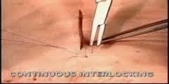 Image result for simple continuous suture pattern