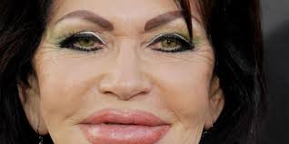 بالصور: مشاهير دمرت حياتهم عمليات التجميل!