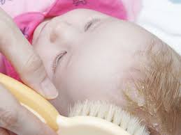 Risultati immagini per crosta lattea