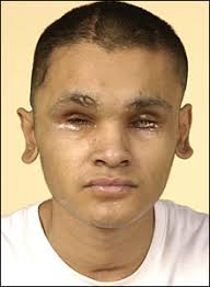 Abdul Malik, 20, who lost his eyes in a drive-by shooting, made an appeal to help catch his attackers. Police believe Mr Malik&#39;s attackers mistook him for ... - _44200775_abdul-malik_220