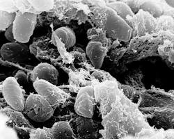 Image of Yersinia pestis bacteria
