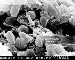 Image of bubonic plague microscopic images