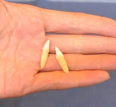 「親知らず site:https://www.8181118.com/」の画像検索結果