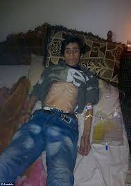 Image result for starving people