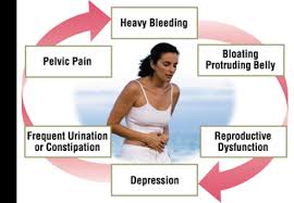 Image result for fibroid