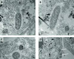 Image of BME/CTVM23 cells