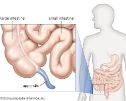 صورة Location of appendix in human body