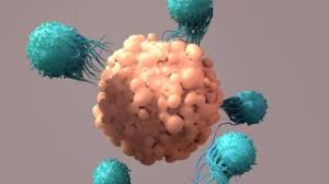 Risk of Secondary Cancers Following CAR-T Cell Therapy: Insights from Stanford Medicine Study - 1