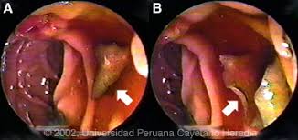 Znalezione obrazy dla zapytania fasciola hepatica