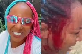 Quem é a funkeira que diz ter sido agredida com pauladas pelo namorado