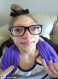 Image result for picture of effects of zika virus in adults