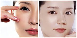 Kết quả hình ảnh cho cắt mí