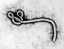 Revelan el estado del doctor con ébola