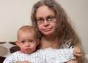 Melanie Bradley và cô con gái 21 tháng tuổi cùng mắc bệnh vẩy cá bóng nước. - benh-la-hai-me-con-bi-lot-da-bong-nuoc-127x91