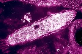 Three deaths reported in New York City Legionnaires’ disease cluster