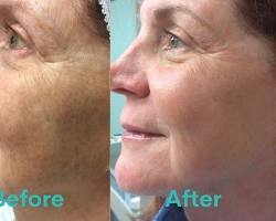 Image of Rejuven Skin Clinic facility or beforeandafter treatment photos