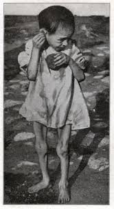 “Through the Eyes of Innocence: The Resilience of Children Who Survived ...