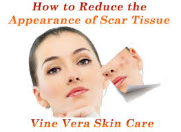 Scar Tissue Treatment - Vine Vera Skin Care. Whether it is from falling off a bike as a kid or undergoing surgery, everybody has scars. - how-to-reduce-the-appearance-of-scar-tissue-vine-vera-skin-care